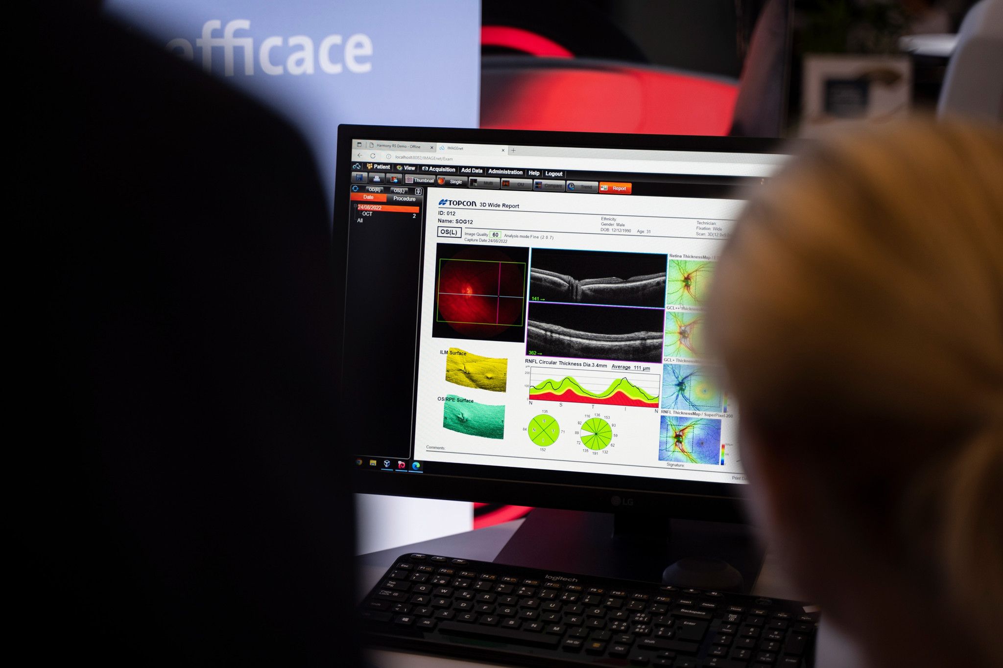 Mediconsult Academy | OCT-Anwenderkurs für diplomierte Augenoptiker:innen und Optometrist:innen